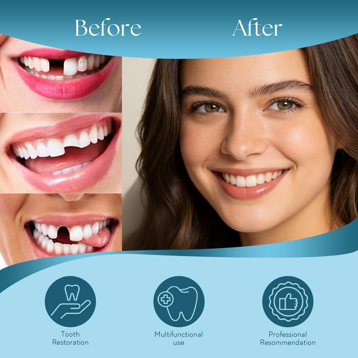 DIY Denture Kit, Temporary Full Set of Dentures Z608